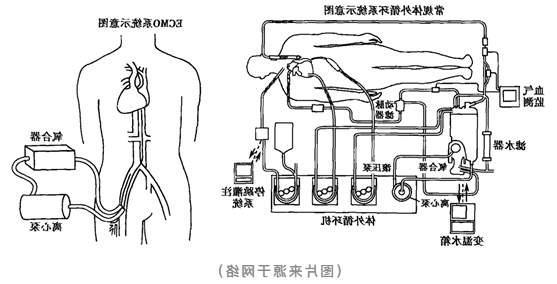 向死神要生命的ECMO：重症监护病房里的终极武器